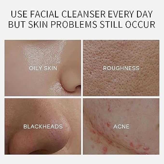 mercham 20 PCS CLAY MASK, DEEP CLEANSE MUD MASK SET, OIL CONTROL, SHRINK PORES, HYDRATING CLAY FACE MASKS GIFT, 100% VEGAN FACE MASKS SKINCARE FOR ALL SKIN TYPES 5G*20 - Image 3